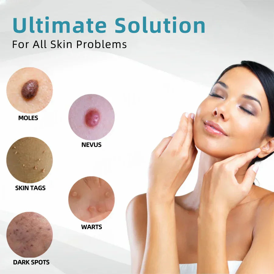 ☂WeHealthine® VelvetSkin+Series ⚔️All-in-One Laser Eraser Pen🖊️ (🔬Powered by CO₂ laser technology – effectively removes moles, warts, skin tags, pigmentation spots, and other skin imperfections)