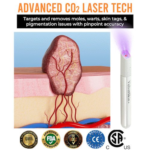 ☂WeHealthine® VelvetSkin+Series ⚔️All-in-One Laser Eraser Pen🖊️ (🔬Powered by CO₂ laser technology – effectively removes moles, warts, skin tags, pigmentation spots, and other skin imperfections)
