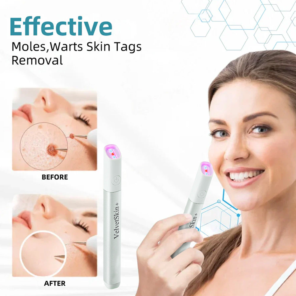 ☂WeHealthine® VelvetSkin+Series ⚔️All-in-One Laser Eraser Pen🖊️ (🔬Powered by CO₂ laser technology – effectively removes moles, warts, skin tags, pigmentation spots, and other skin imperfections)